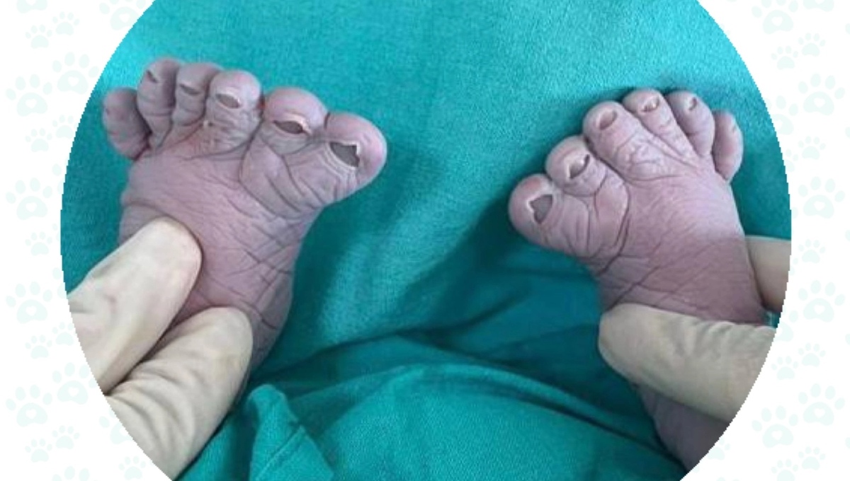 Россиянка родила третьего ребёнка, у каждого по 22 пальца