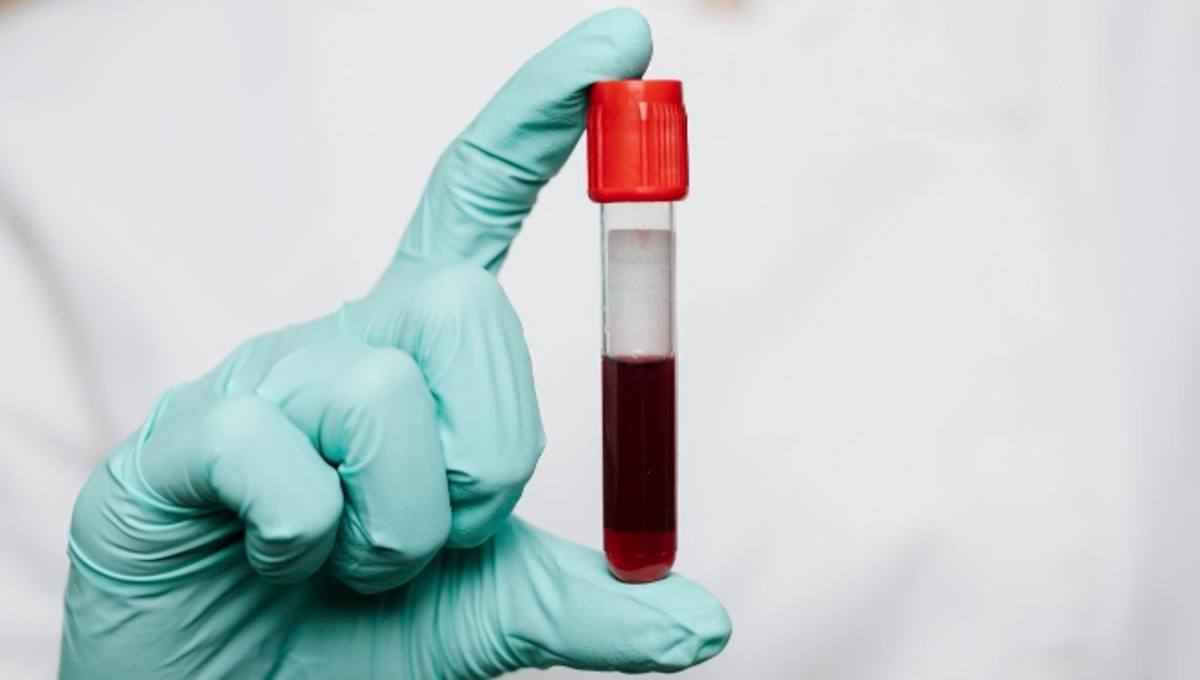 Первый взрослый россиянин получил российскую Car-t терапию от рака