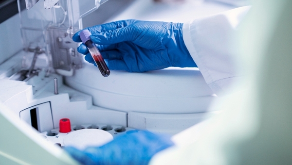 Первый случай в России. Роспотребнадзор объявил о прецеденте опасного заболевания