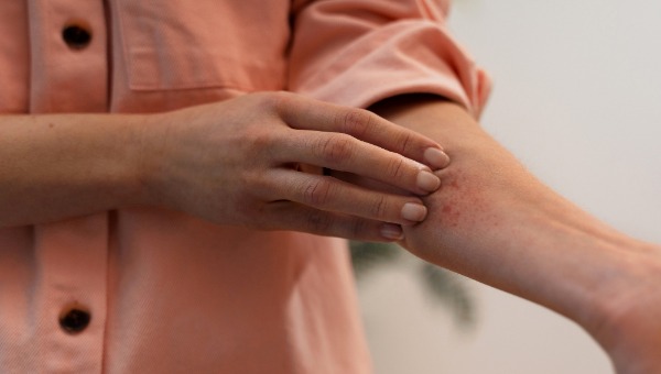 Обновилась статистика по укусам клещей в этом сезоне в Подмосковье