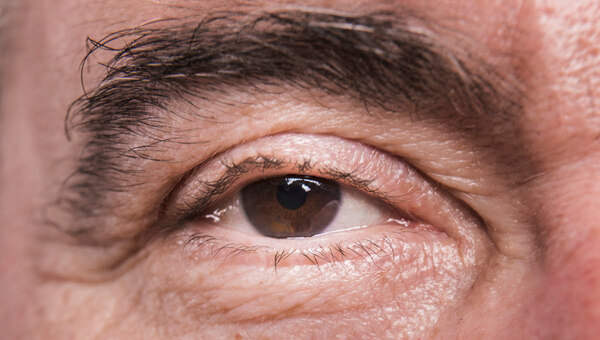 Неожиданный путь к ясному взгляду пациента нашли столичные врачи